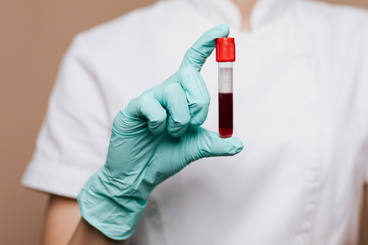 Blood test