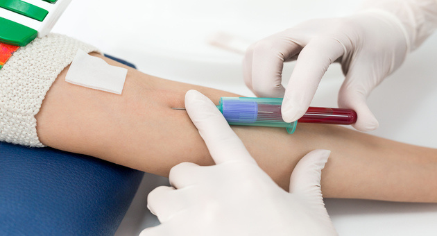 Here Is What You Need To Know When Getting A Blood Test Done  Tata 1mg