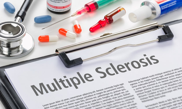 Unfolding Multiple Sclerosis: From Causes To Management Strategies