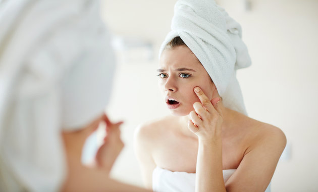 Acne – Do's And Don’ts You Must Follow