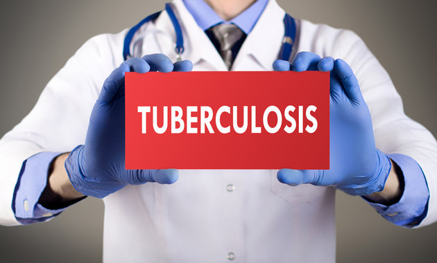 Busting Common Myths About Tuberculosis