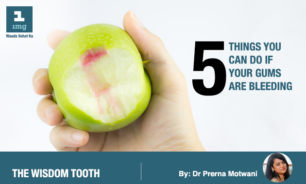 5 things you can do if your gums are bleeding