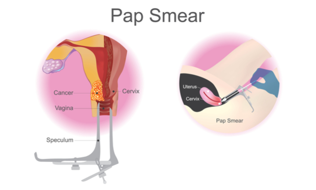 Image showing fundamentals of pap smear test