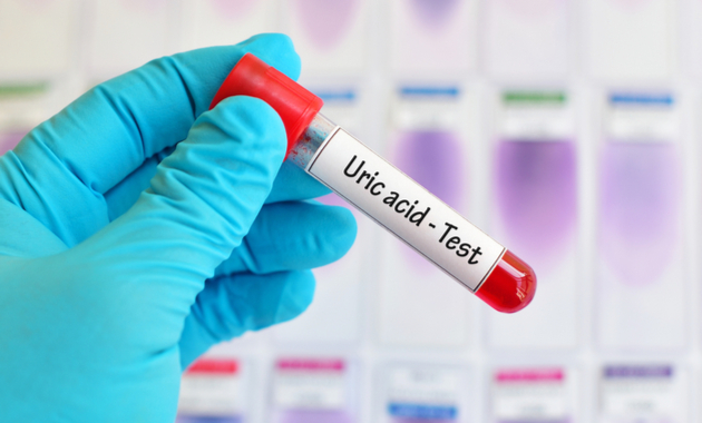uric acid test