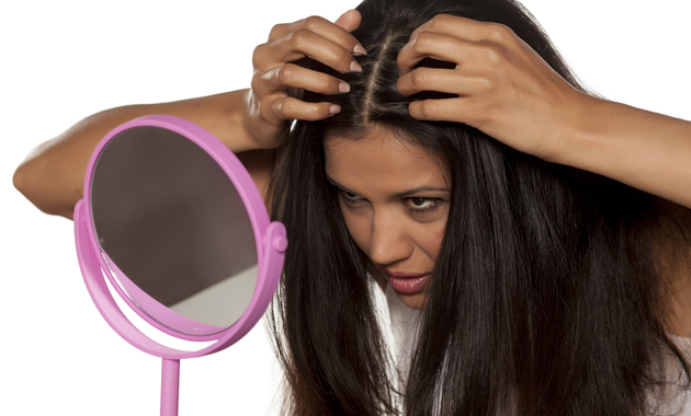 home remedies of dandruff in hindi