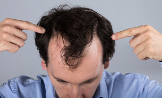 Hair Loss Treatment: Medicines For Hair Fall And Hair Regrowth - Tata 1mg  Capsules