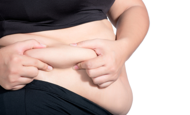obesity in women