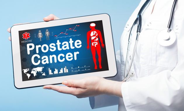 prostate cancer myths