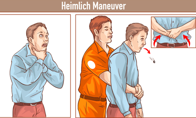 first aid for choking