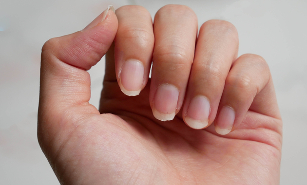 vertical ridges on nails 