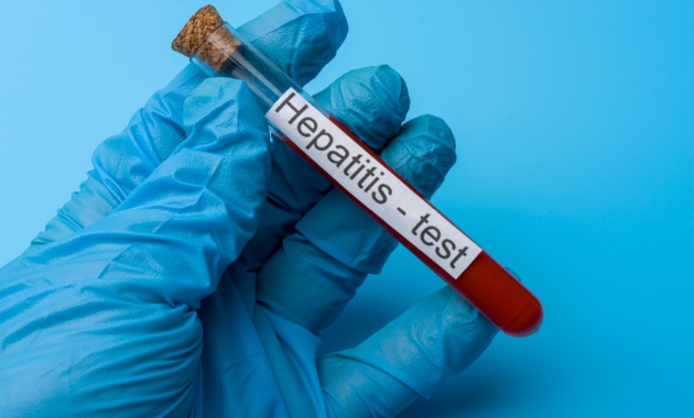 hepatitis diagnosis