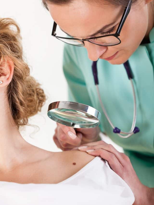 Is It A Cancerous Mole? 5 Ways To Identify Is It A Cancerous Mole? 5 Ways To Identify