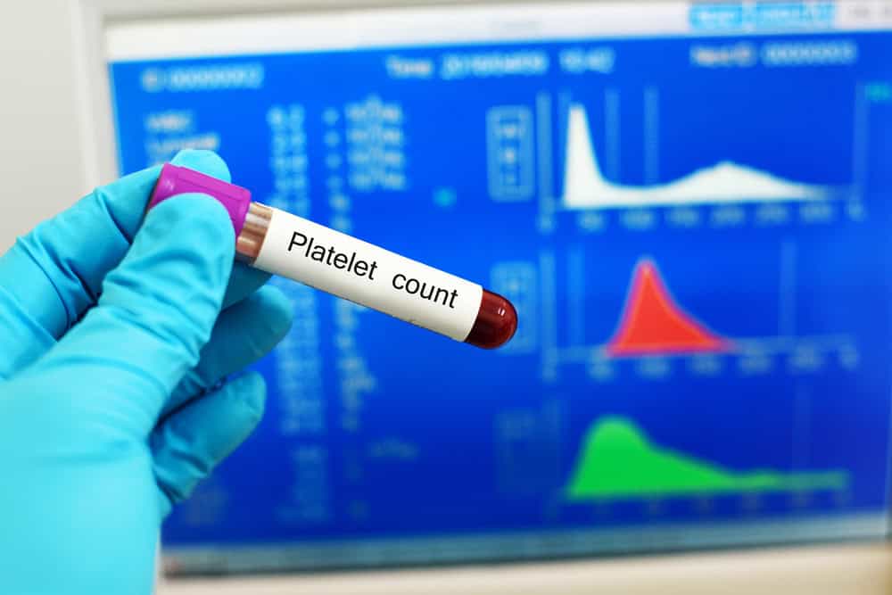 Platelet count