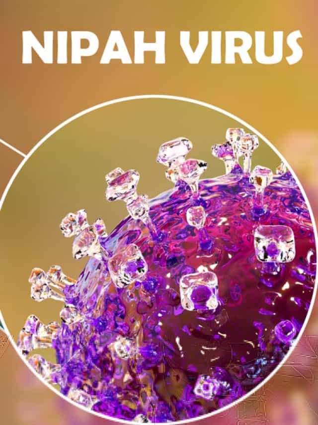 Nipah Virus: 5 Ways To Prevent It Nipah Virus: 5 Ways To Prevent It