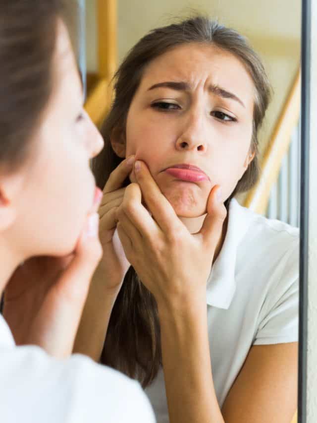 Surprising Reasons Why You Should Never Pop Pimples Surprising Reasons Why You Should Never Pop Pimples