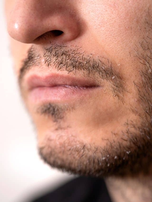 5 Home Remedies To Fix A Patchy Beard 5 Home Remedies To Fix A Patchy Beard