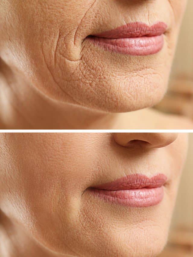 5 Mistakes That Will Make You Age Faster 5 Mistakes That Will Make You Age Faster