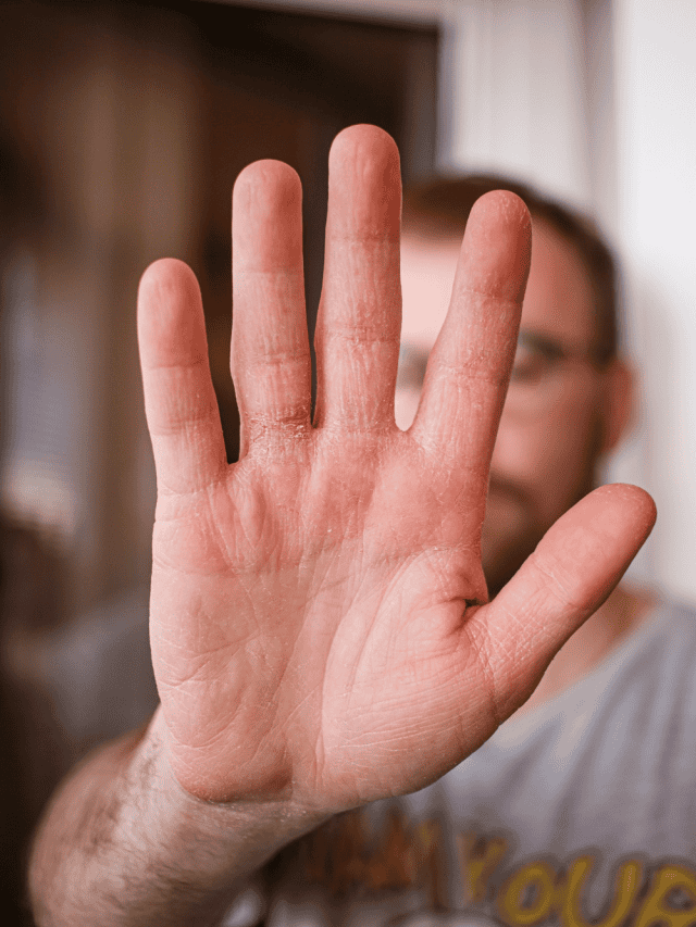 5 Things Your Swollen Fingers Are Telling You
