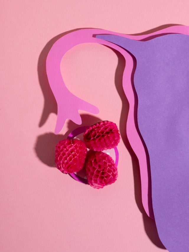 What People Think PCOS Is vs. What It Really Is What People Think PCOS Is vs. What It Really Is