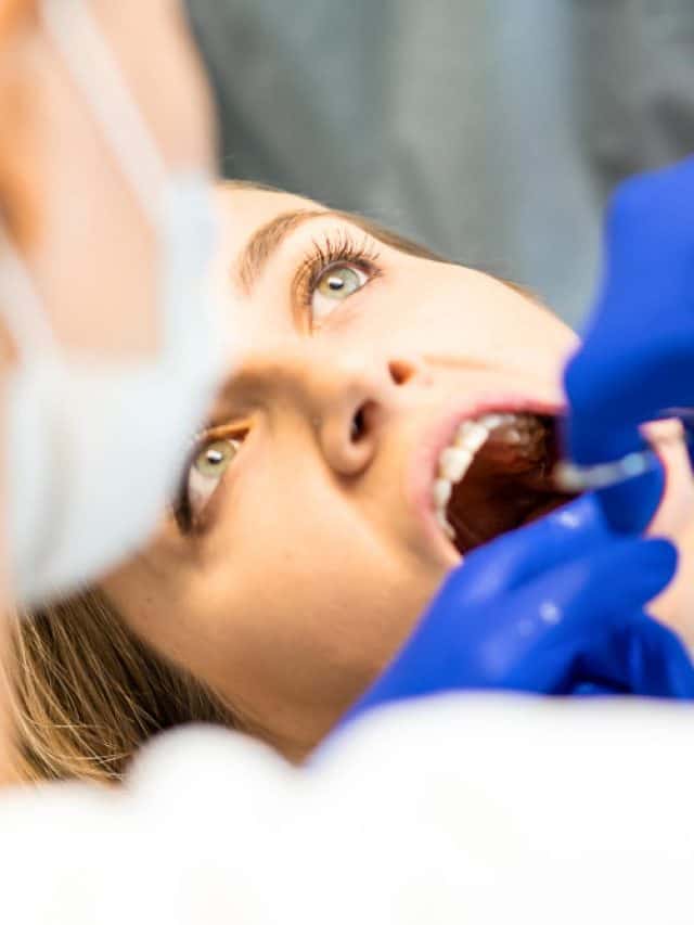 How To Prevent Cavities? How To Prevent Cavities?