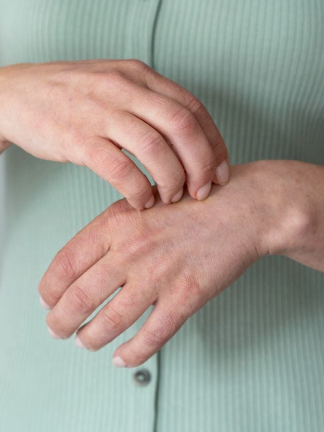 5 Effective Home Remedies For Fungal Infection 5 Effective Home Remedies For Fungal Infection
