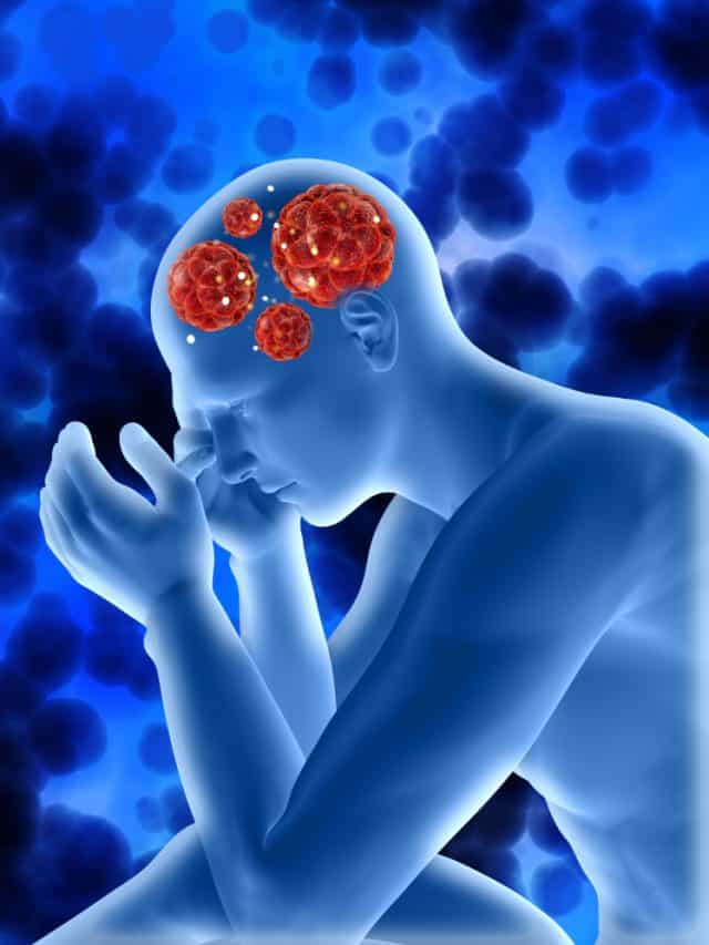 5 Most Common Symptoms Of Schizophrenia 5 Most Common Symptoms Of Schizophrenia