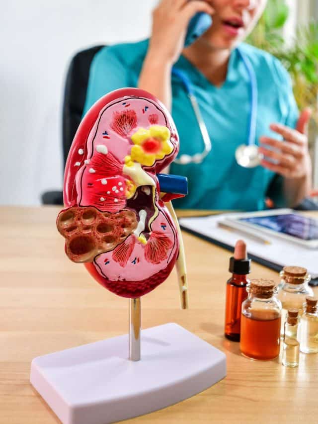 5 Foods That Support Kidney Health