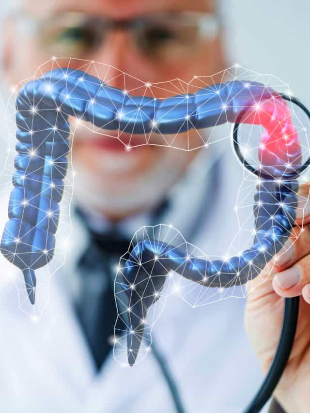 Know The 7 Common Causes Of Colon Cancer Know The 7 Common Causes Of Colon Cancer