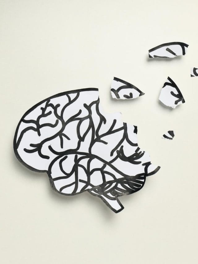 Can You Have Alzheimer’s Without Symptoms? Can You Have Alzheimer’s Without Symptoms?