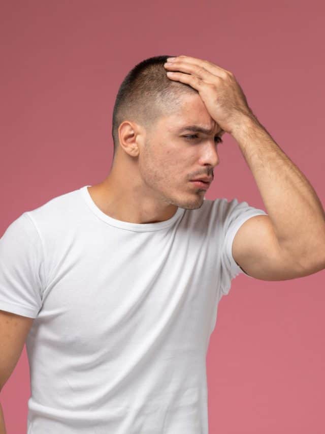 What To Know About Hair Fall In Men What To Know About Hair Fall In Men