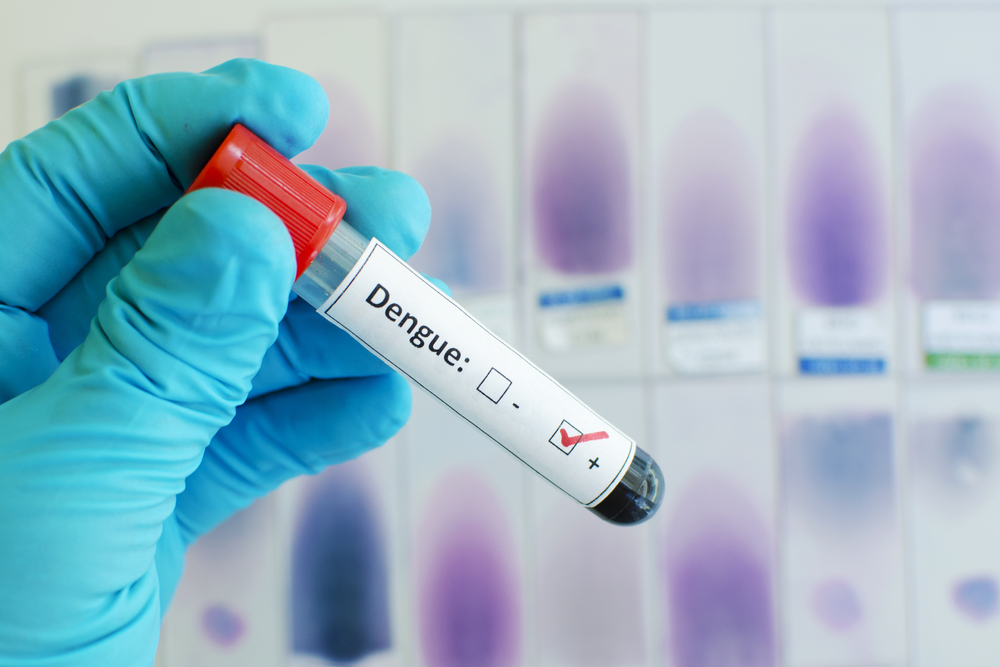 Dengue tests