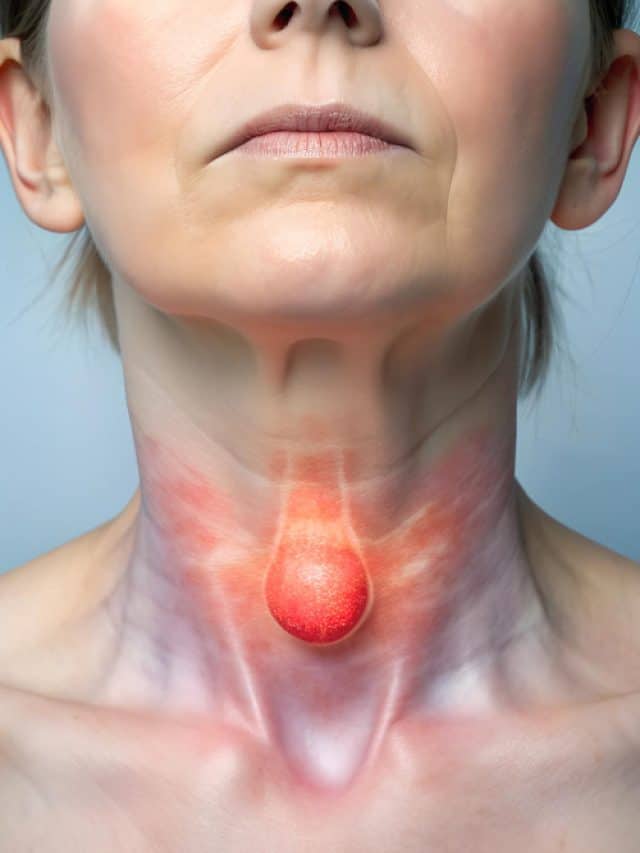 7 Warning Signs Of Thyroid Problems In Women 7 Warning Signs Of Thyroid Problems In Women