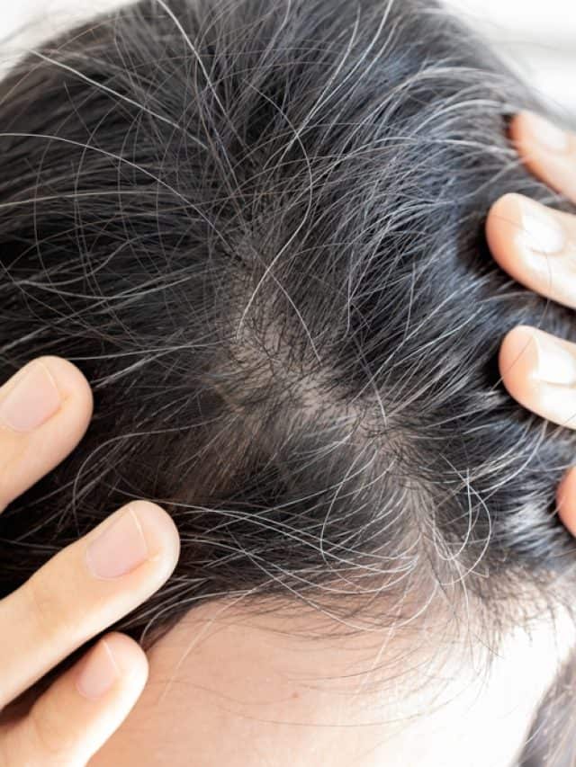 8 Risk Factors Of Grey Hair In Your 20s