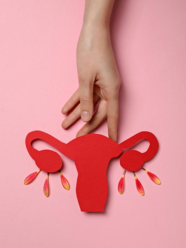 5 most commonly asked questions on PCOS