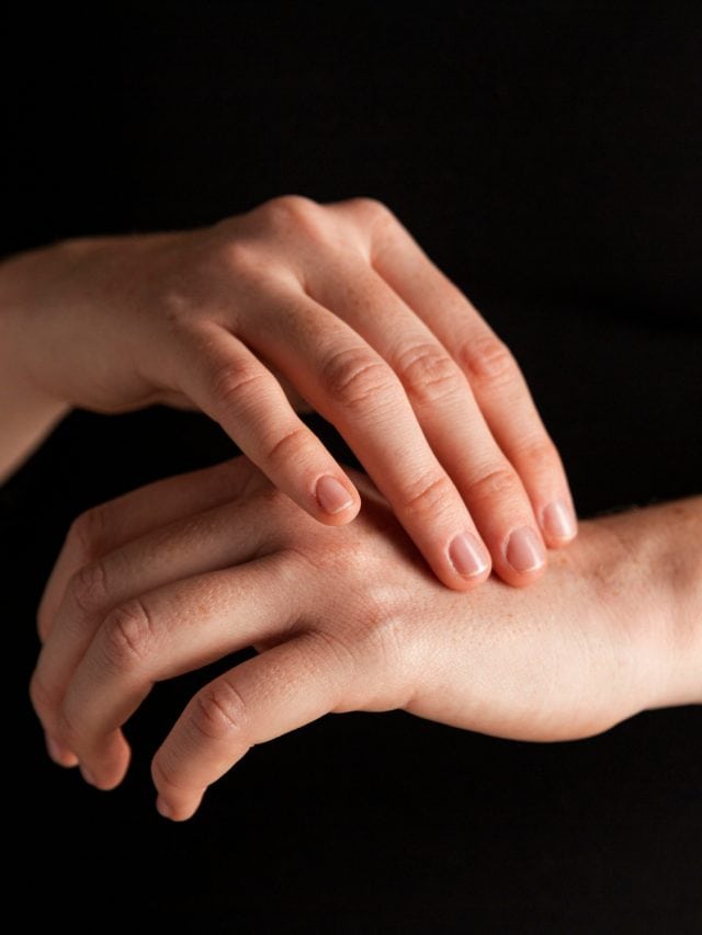 5 Ways To Take Precautions Against Fungal Diseases
