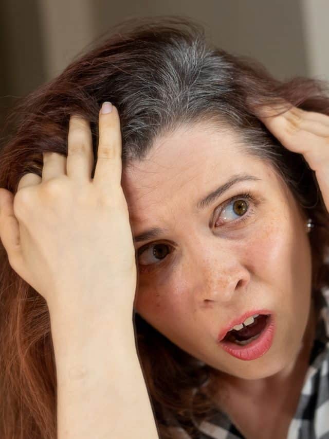 5 Ways To Prevent Gray Hair Naturally 5 Ways To Prevent Gray Hair Naturally