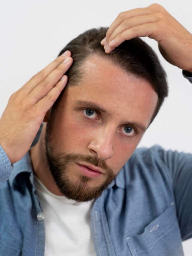 Best hair loss treatments