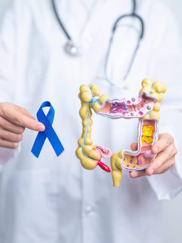 Are these foods putting you at risk of bowel cancer? Are these foods putting you at risk of bowel cancer?