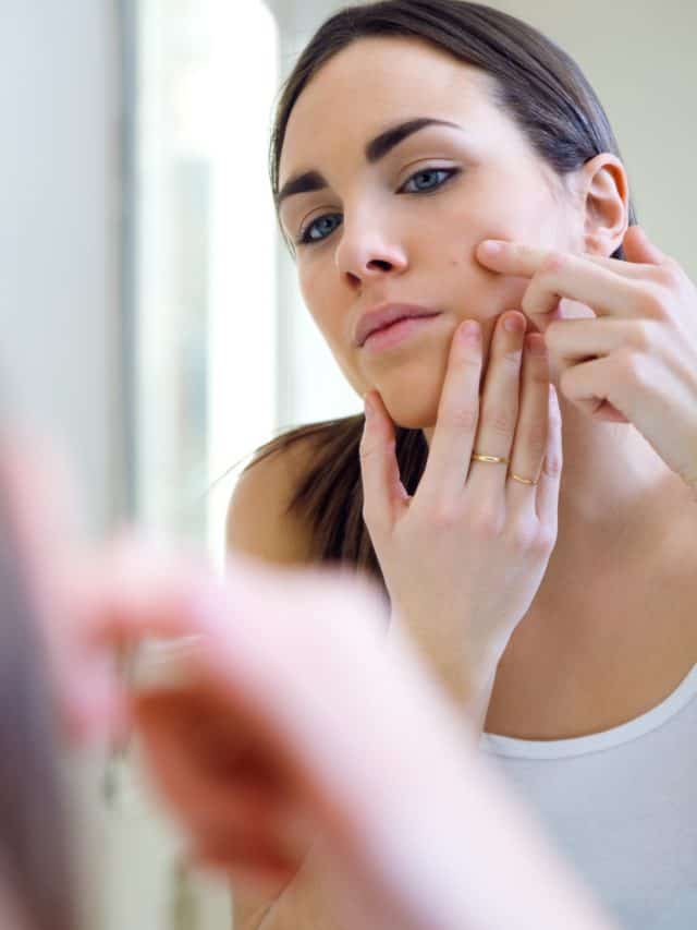 How to prevent cracking skin In winter