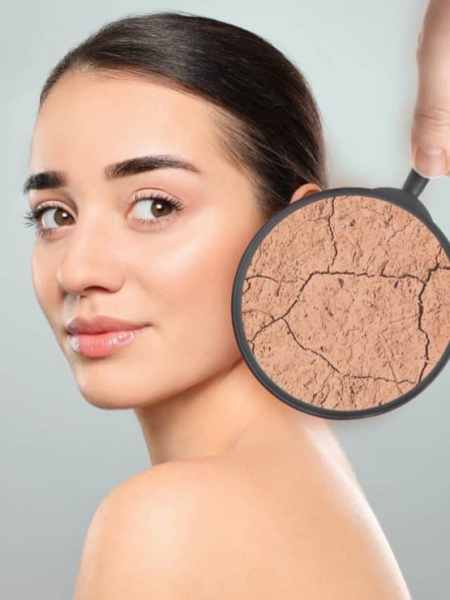 5 common causes of dry skin