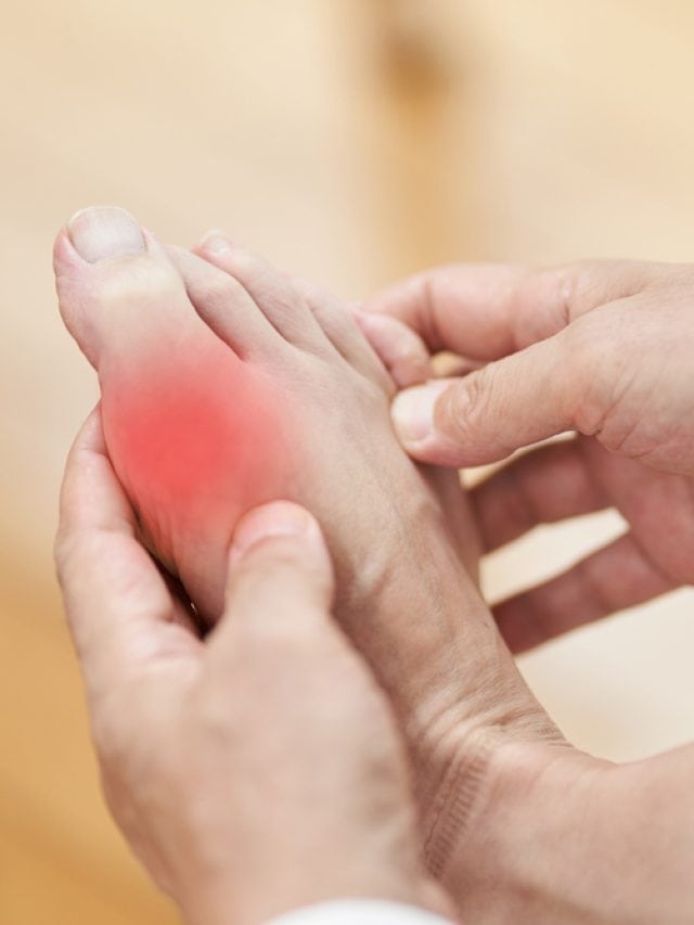 5 morning habits to naturally lower uric acid levels