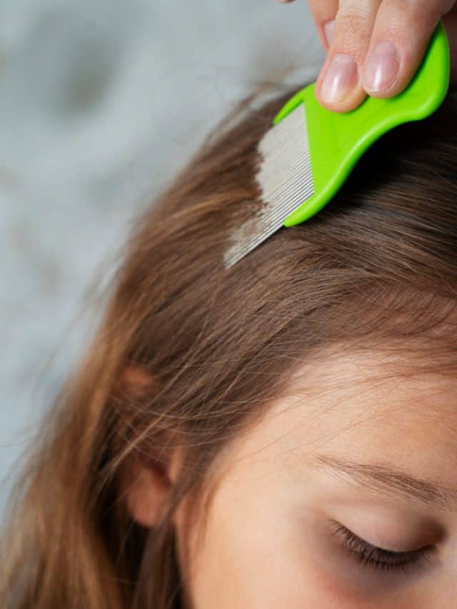 6 best home remedies to remove lice from your child’s hair