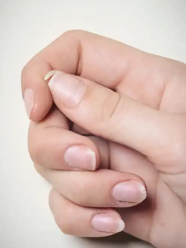 Why your nails are so brittle, and what to do about it?
