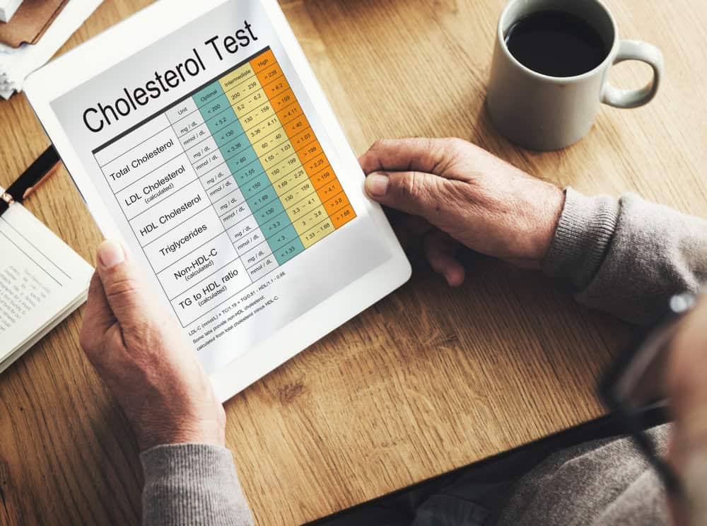 lipid profile test