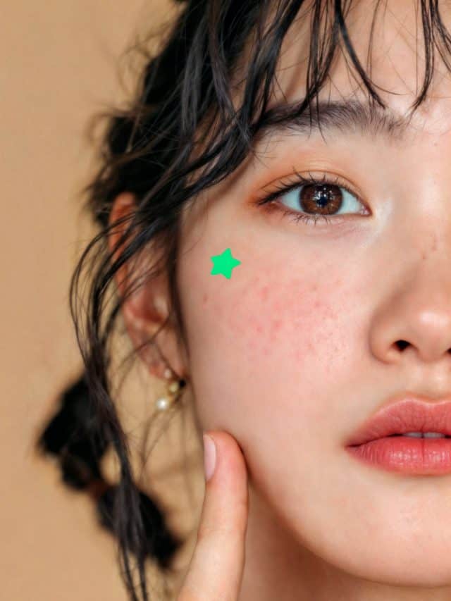 What foods can trigger acne breakouts? What foods can trigger acne breakouts?