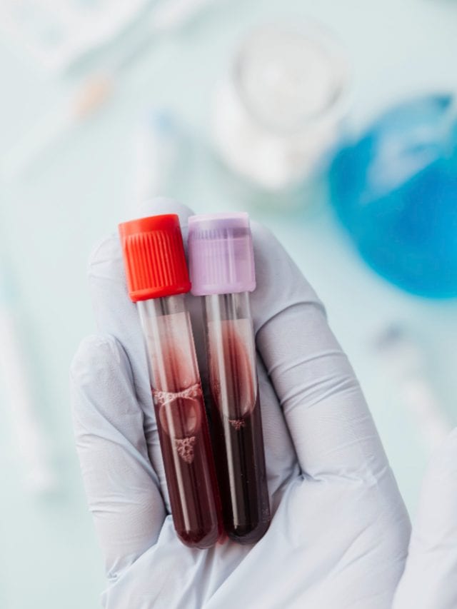What your lipid profile is not telling you about your heart?