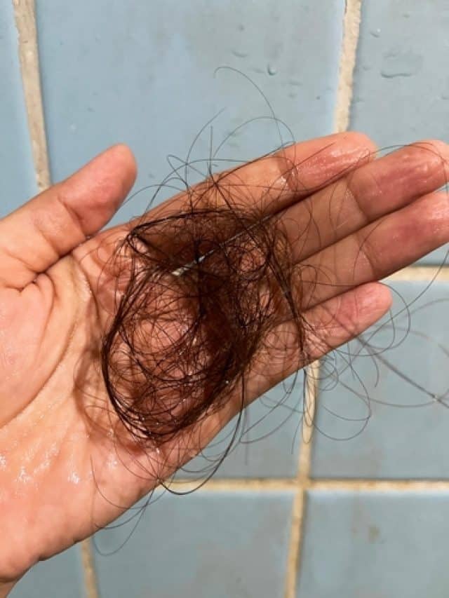 हेयरफॅाल कम करने के लिए घर पर बनाकर इस्तेमाल करें ये 5 तेल हेयरफॅाल कम करने के लिए घर पर बनाकर इस्तेमाल करें ये 5 तेल
