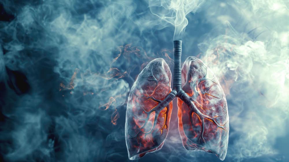 Effects of air pollution