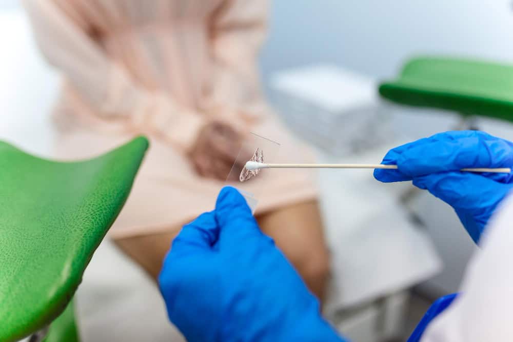 pap smear test, HPV DNA test