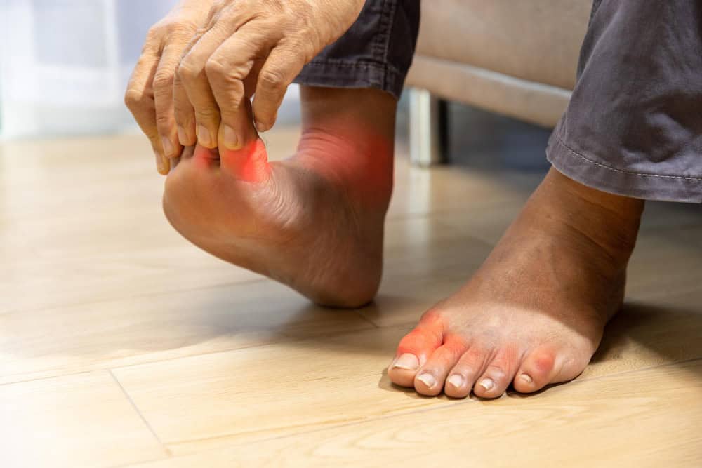 uric acid, gout